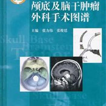 《颅底及脑干肿瘤外科手术图谱》通过图文结合形式介绍了最常见的颅底和脑干肿瘤病例，并详尽地论述了多种疾病的影像、手术入路、术中情况及手术注意事项。本图谱不仅适合从事颅底及脑干肿瘤专业的神经外科医生，同样适合神经肿瘤病理、影像、监测及耳鼻喉科等医师参考。原价188元，现团购价49元包邮！