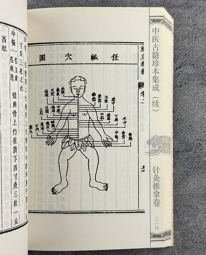 团购：中医古籍珍本集成:针灸推拿卷2种3册》,《团购：中医古籍珍本集成